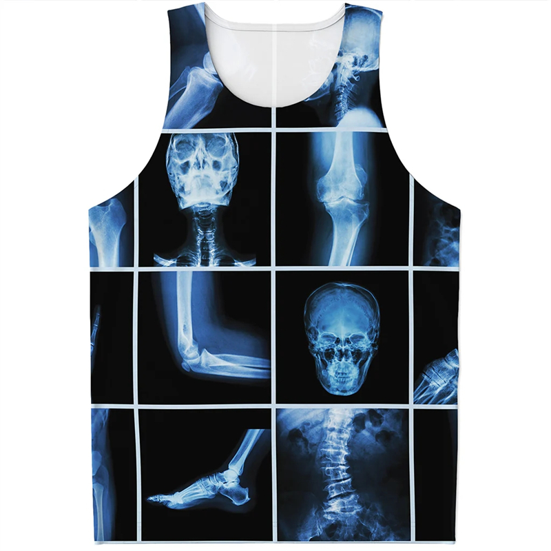 2024 Nieuwe Mode X-Ray Tank To - Summer Rays Clothing recensie en prijs